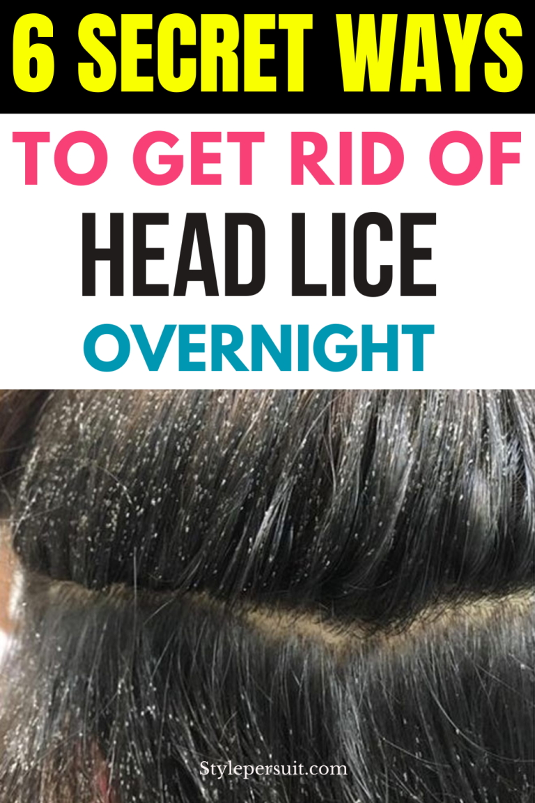 How to Get Rid of Lice from Hair: Effective Home Remedies for Lice ...