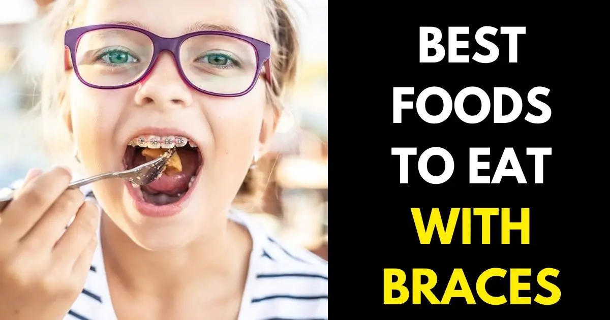 FOODS TO EAT WITH BRACES