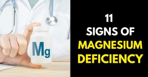 11 Signs of Magnesium Deficiency You Should Know – StylePersuit