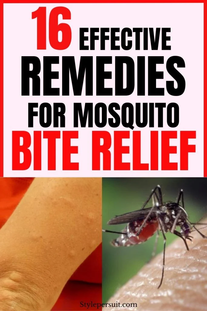 MOSQUITO BITE REMEDIES