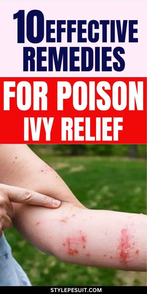 Poison Ivy Remedies