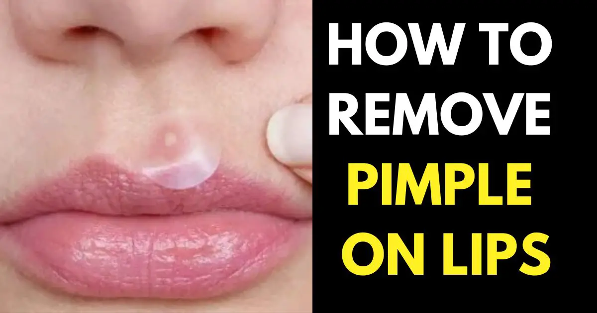 remove pimple on lips