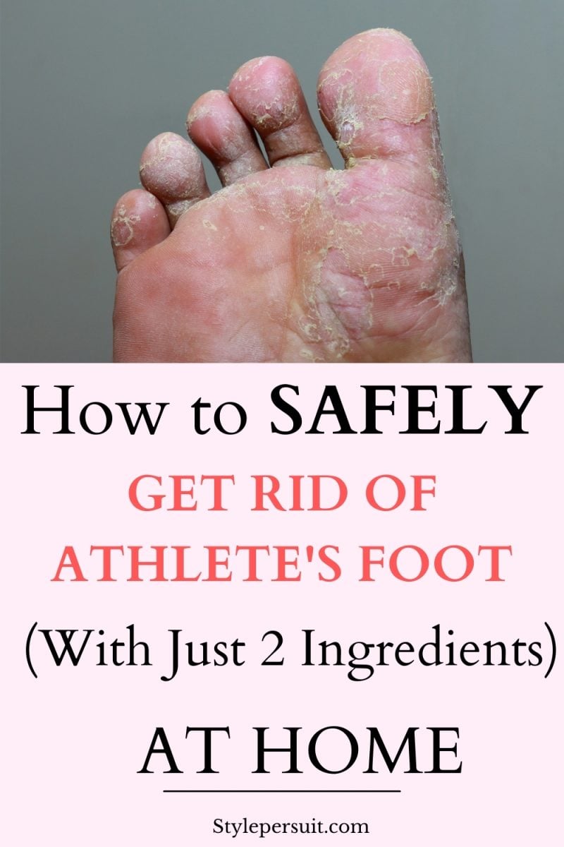 10 best home remedies for athlete s foot stylepersuit