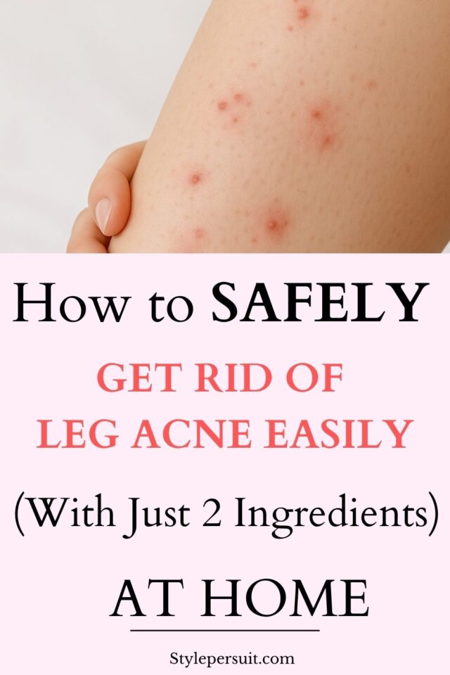 Picture of Say Goodbye to Leg Acne : 6 Effective Home Remedies for Leg Pimple That ...